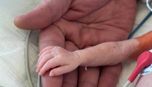 В Інституті серця вдало прооперовано дитину з вагою 1,1 кг.