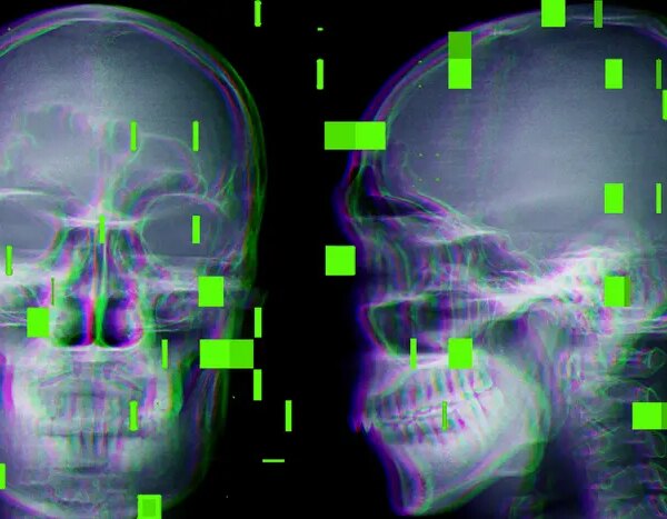 Штучний розум у сфері лікування завдав шкоди багатьом хворим.