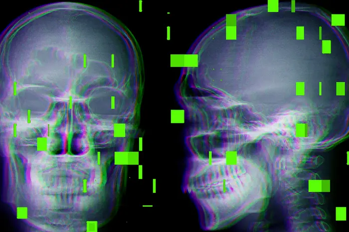 Штучний інтелект в медицині покалічив десятки пацієнтів